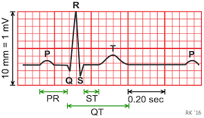 Arrhythmias in Children | www.kidshearts.co.uk